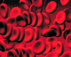 Acumulación de cuerpos cetonos en la sangre en la diabetes
